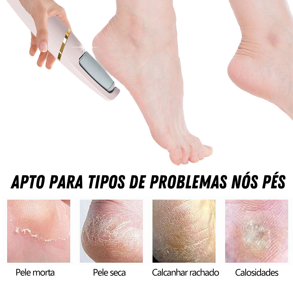 Lixa de Pé Elétrica - Tira Calos Pedicure Portátill (ÚLTIMAS UNIDADES)