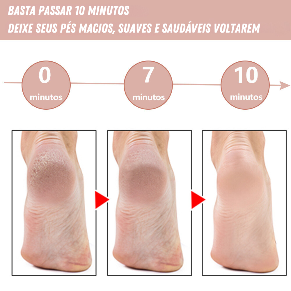 Lixa de Pé Elétrica - Tira Calos Pedicure Portátill (ÚLTIMAS UNIDADES)