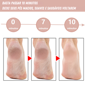 Lixa de Pé Elétrica - Tira Calos Pedicure Portátill (ÚLTIMAS UNIDADES)
